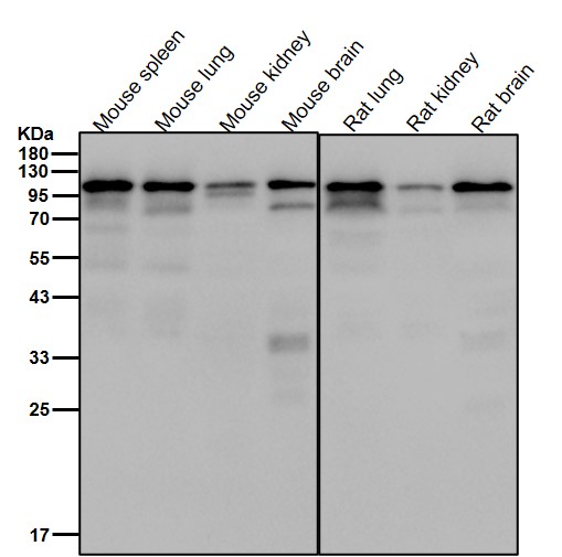 Discoidin domain receptor 2 Ab