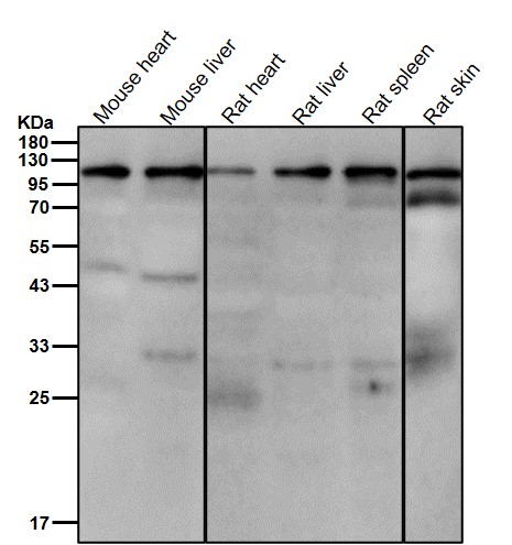 Discoidin domain receptor 2 Ab