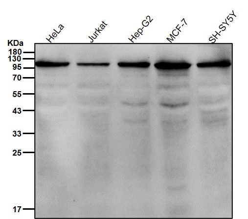 Discoidin domain receptor 2 Ab