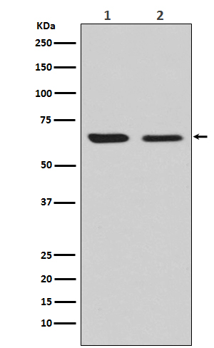 DRP 2 Ab