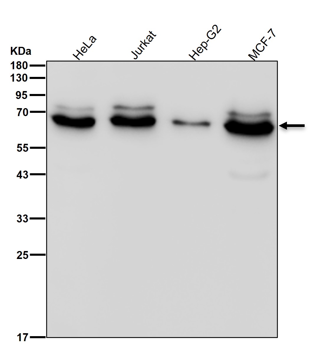 DRP 2 Ab