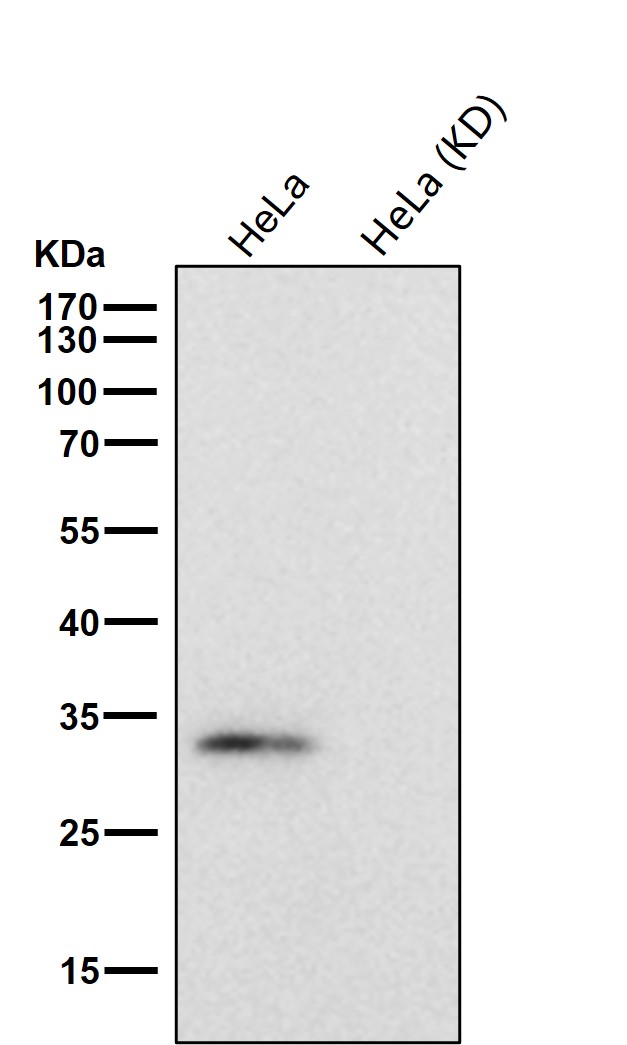 Complement C1q binding protein Ab