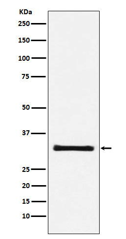 Complement C1q binding protein Ab