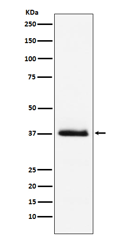 Parathyroid hormone Ab