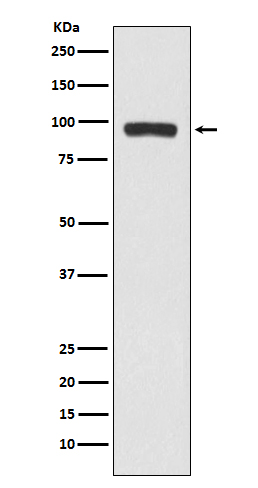 Cholinesterase Ab