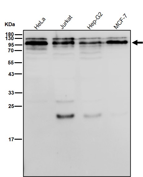 Cholinesterase Ab