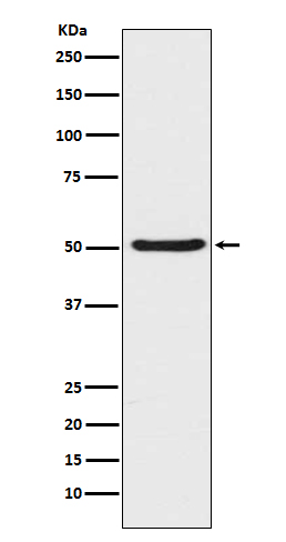 Angiopoietin 2 Ab