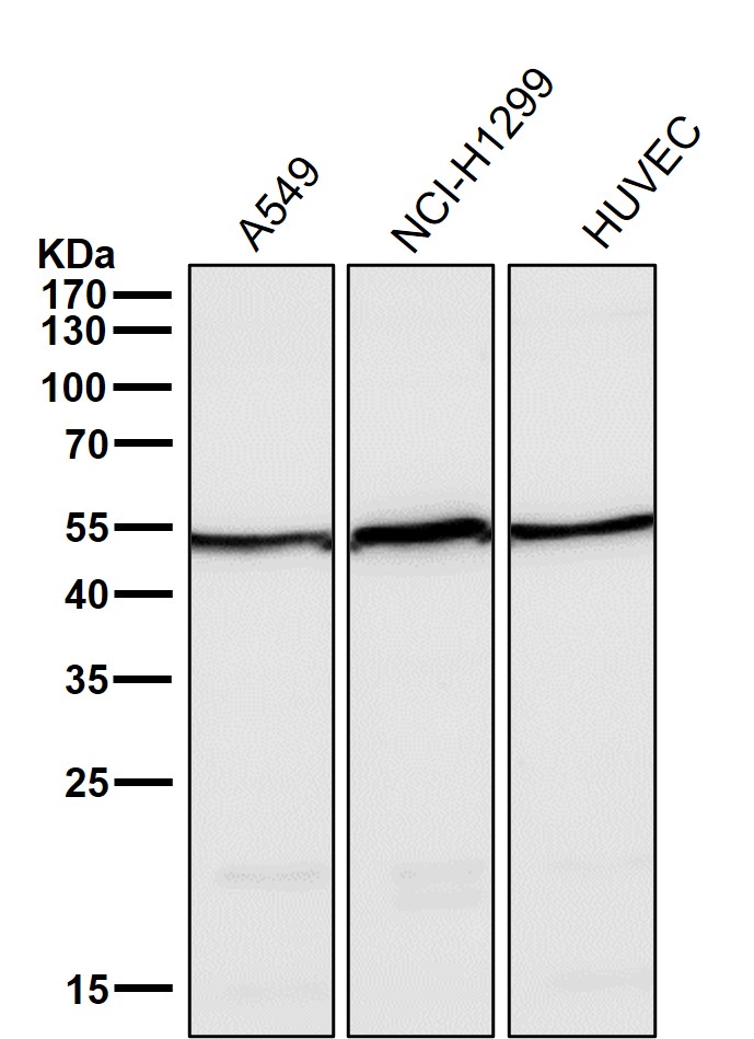 Angiopoietin 2 Ab