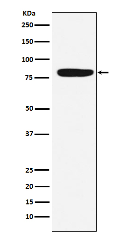 Coagulation factor XIII A Ab