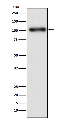 GABA B receptor 1 Ab