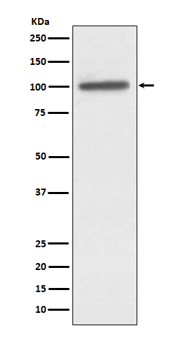 alpha Actinin 4 Ab