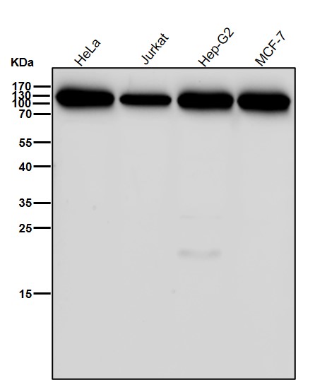 alpha Actinin 4 Ab