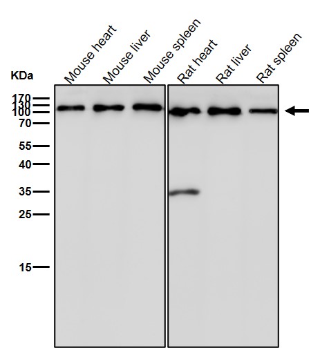 alpha Actinin 4 Ab