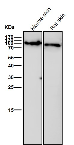 alpha Actinin 4 Ab