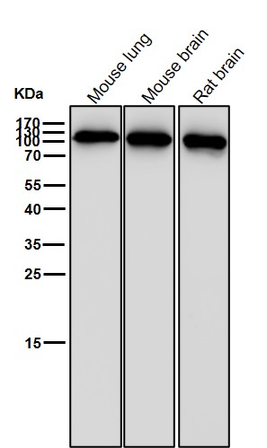 alpha Actinin 4 Ab