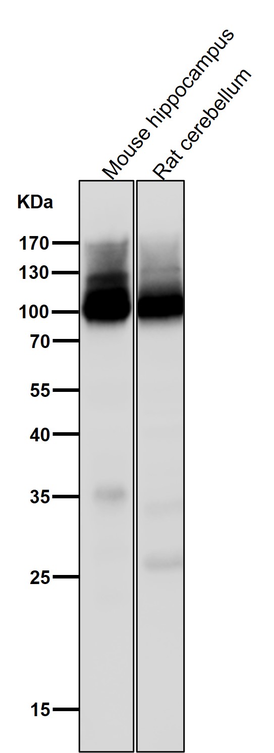 GluR2 Ab