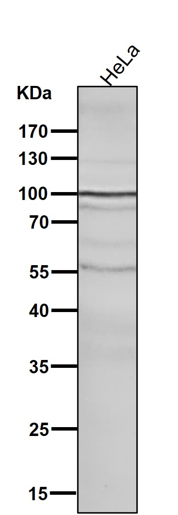 GluR2 Ab