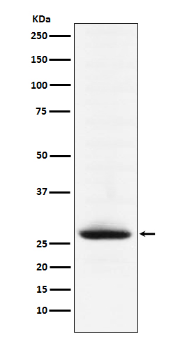 Myelin oligodendrocyte glycoprotein Ab