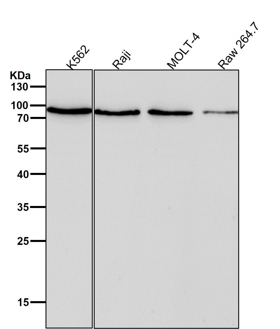 Prolactin receptor Ab