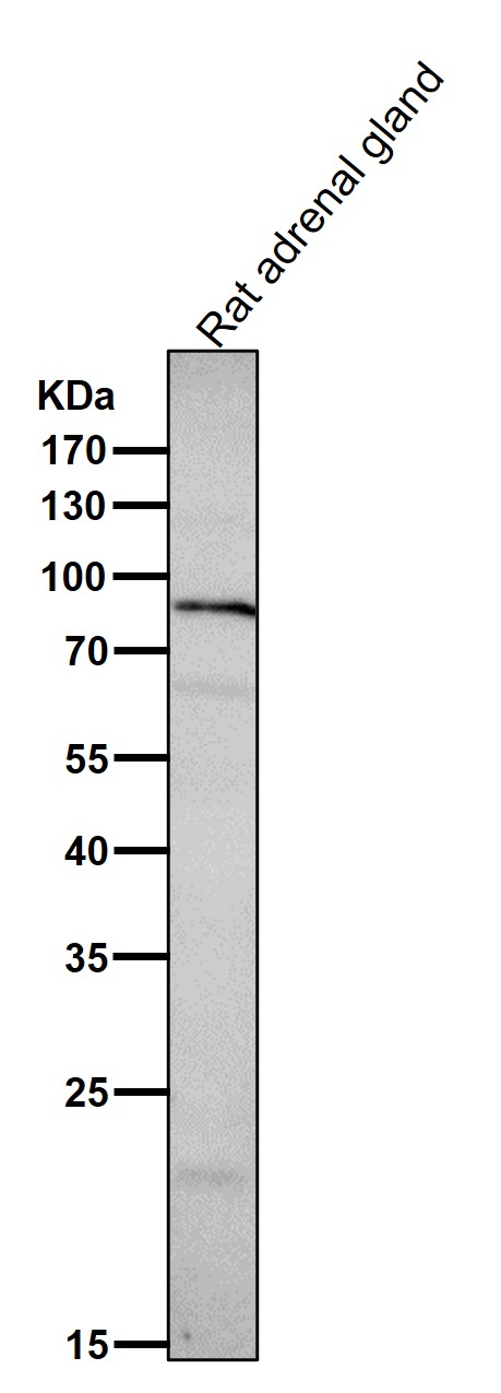 Prolactin receptor Ab