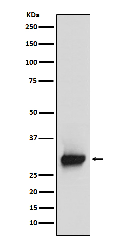 Calretinin Ab