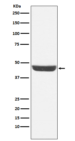 NDRG1 Ab