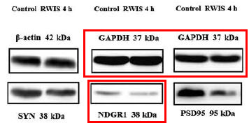 NDRG1 Ab