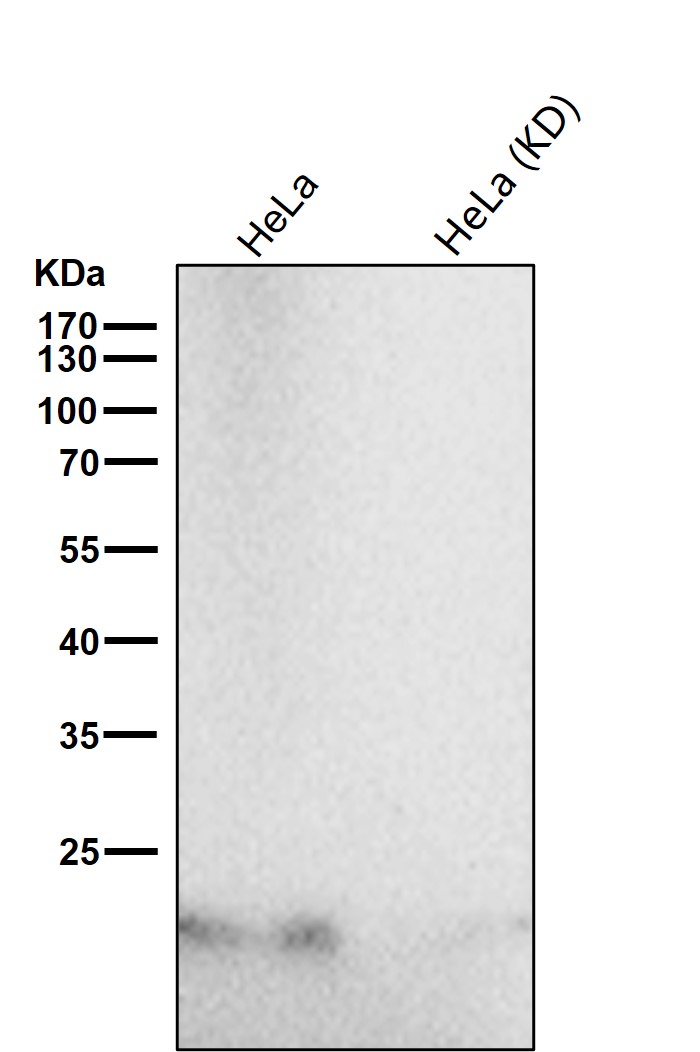 Ferritin heavy chain Ab