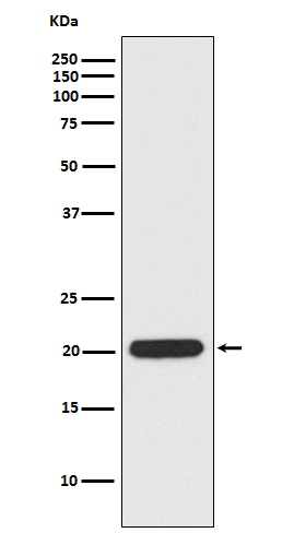 Ferritin heavy chain Ab