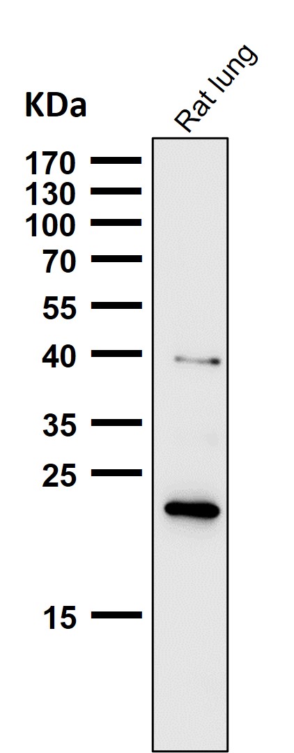 Ferritin heavy chain Ab