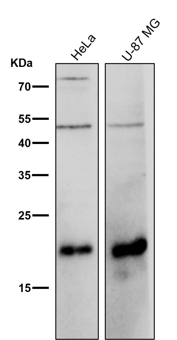 Ferritin heavy chain Ab