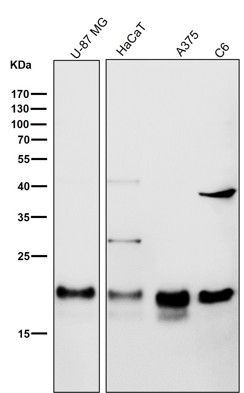 Ferritin heavy chain Ab