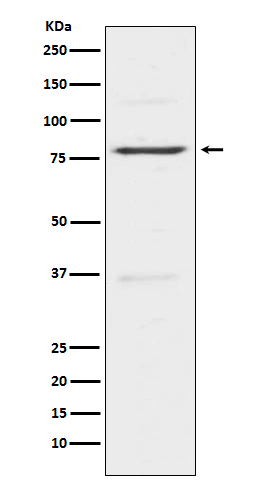 Insulin receptor related protein Ab