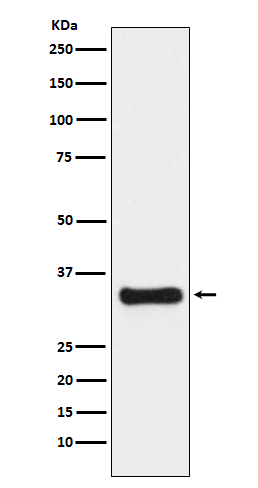 Thymidylate synthase Ab