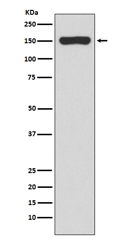 RNA polymerase beta Ab