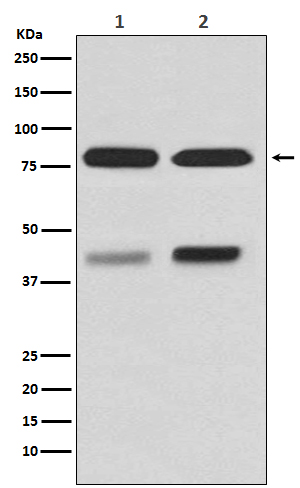 PKC beta Ab