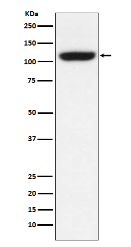 TRPM8 Ab