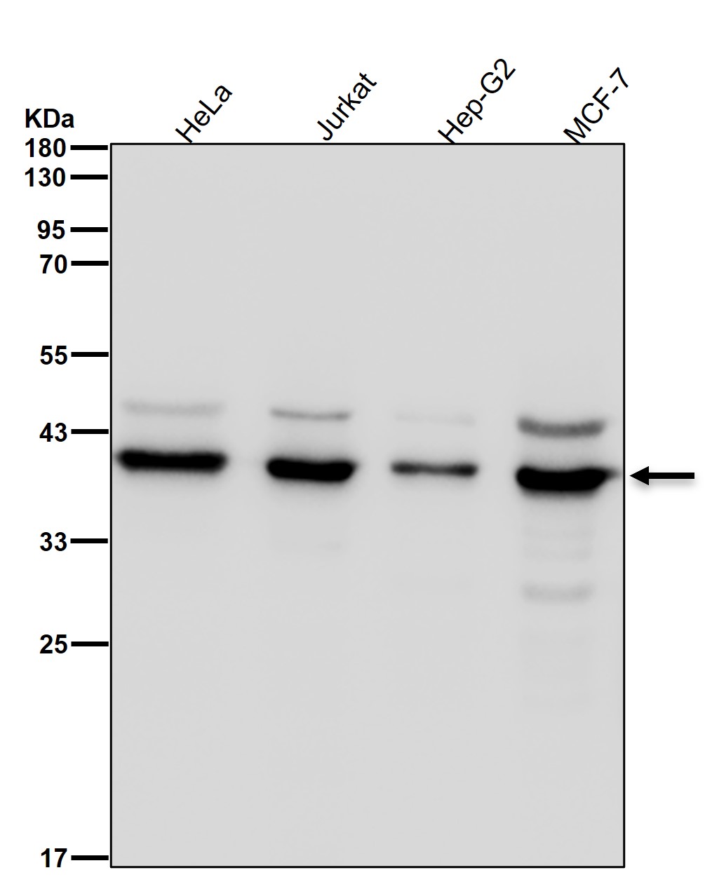 Histone mH2A1 Ab