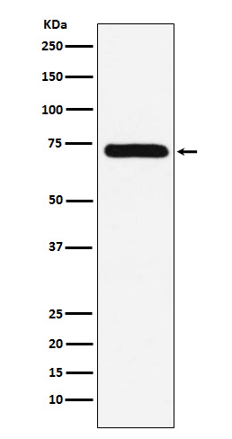 Coagulation factor X Ab