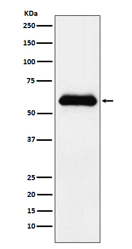 alpha 1 Antichymotrypsin Ab