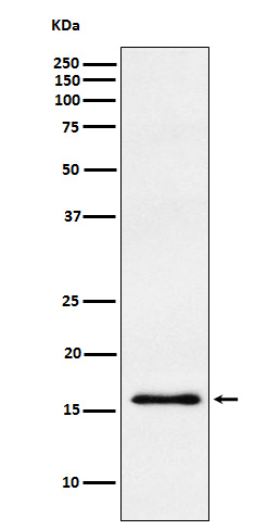 gamma Synuclein Ab