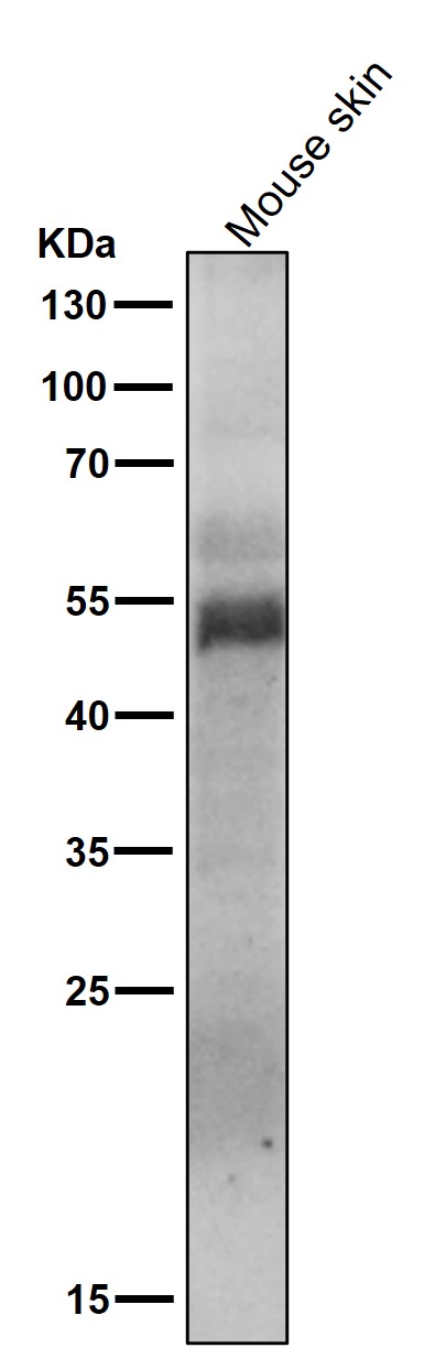 p-MLKL (S358) Ab