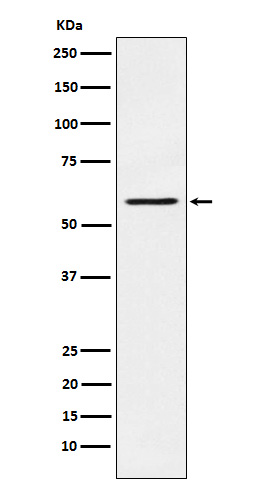 PAK1 Ab