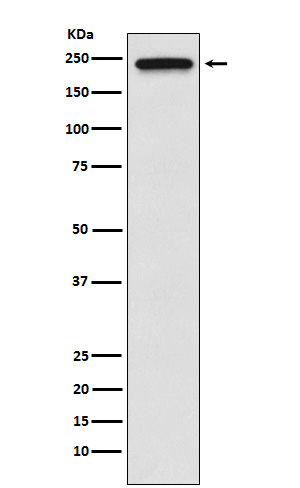 TRPM7 Ab