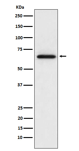 MMP2 Ab