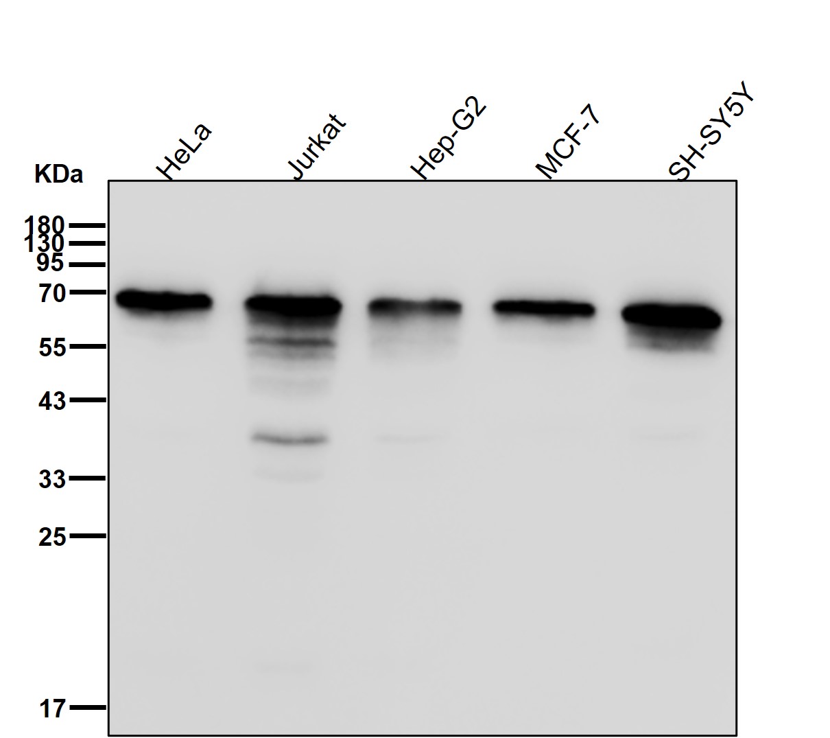 NRF 1 Ab