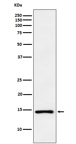 Natriuretic peptides A Ab