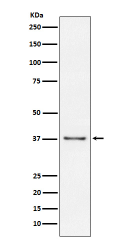 CD23 Ab