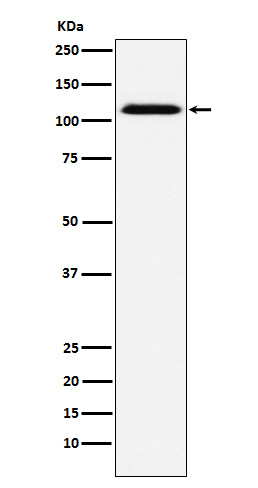 CD30 Ab