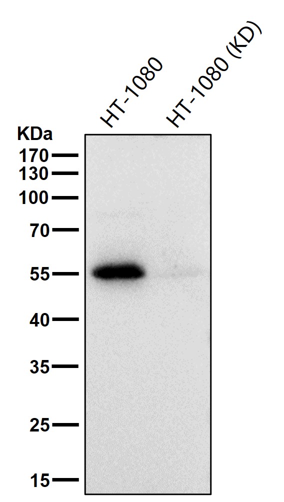 PFKFB3 Ab